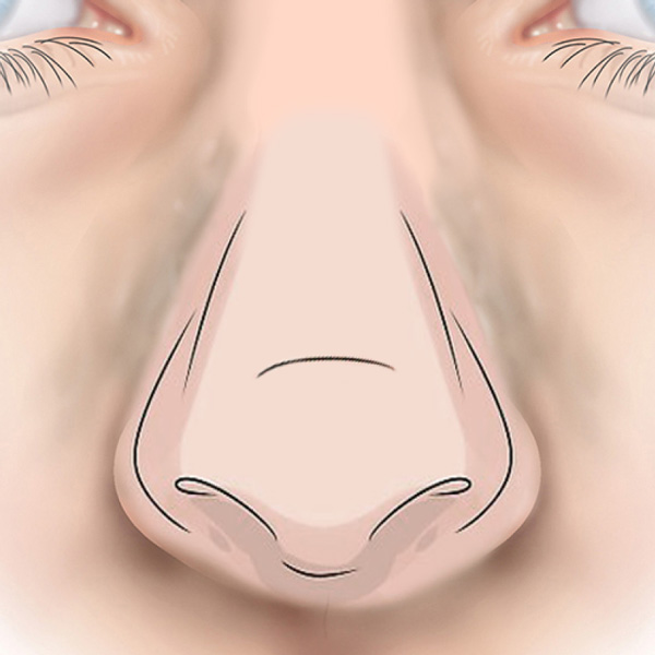 Allergic crease